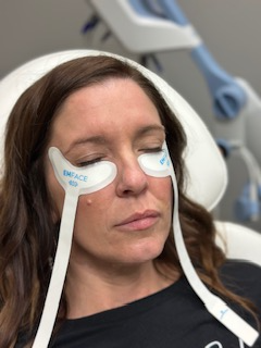A patient at SculptU relaxes with her eyes closed as she undergoes her eye treatment in Louisville using Emface Eye. The special under-eye applicators stimulate muscle contractions under the eyes to provide a natural lift.